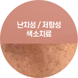 홍조 / 혈관성 색소치료